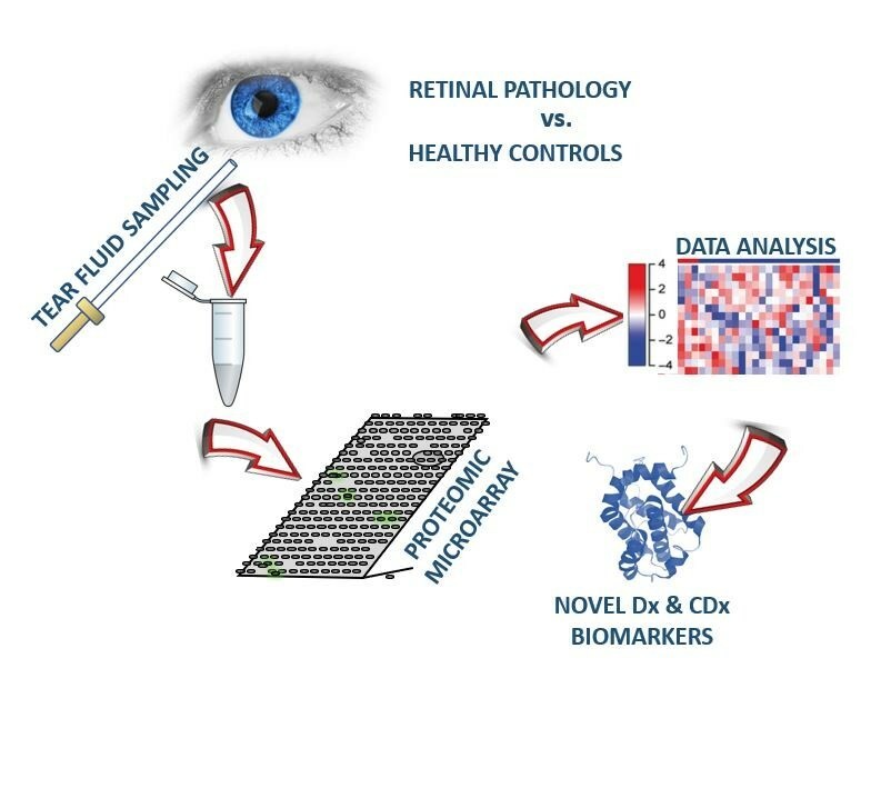 The Technology for the potential diagnosis of retinal diseases with natural tears - BioLight Life Sciences (PRNewsfoto/BioLight Life Sciences Ltd.)