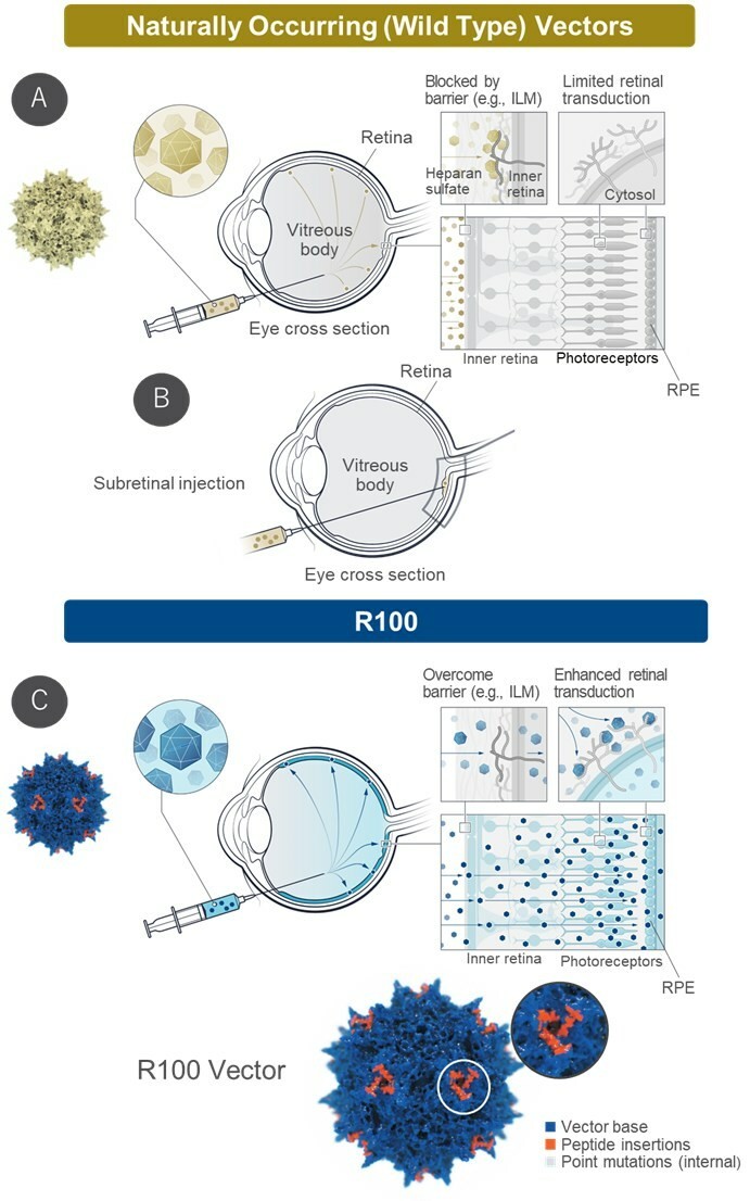 R100 Structure & Target Vector Profile ~Intravitreal Delivery for Retinal Diseases~
A) Naturally occurring vectors cannot effectively reach the retina from the vitreous due to the inner limiting membrane (ILM)
B) Therefore in many cases, genetic medicines utilizing naturally occuring vectors require subretinal injection via vitrectomy surgery
C) R100 was customized and evolved to overcome the ILM barrier and transduce the retina with a routine intravitreal injection