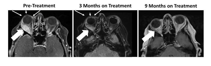 Figure 1: Responder Images - Bria-IMT™ Regimen