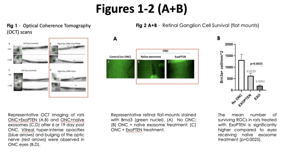 Promising Preclinical Results in Restoring Vision After Optic Nerve Damage